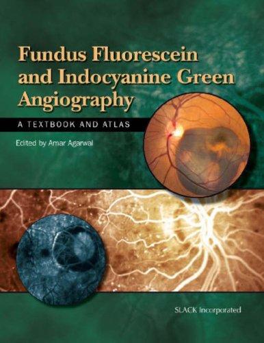 Cover for Fundus Fluorescein and Indocyanine Green Angiography