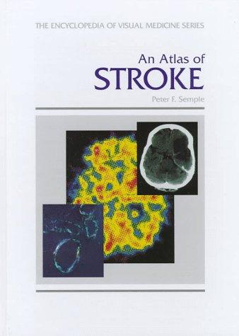 Cover for An atlas of stroke