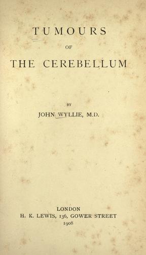 Cover for Tumours of the cerebellum.