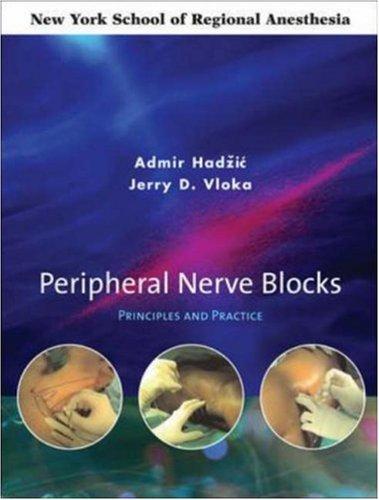 Cover for Peripheral nerve blocks