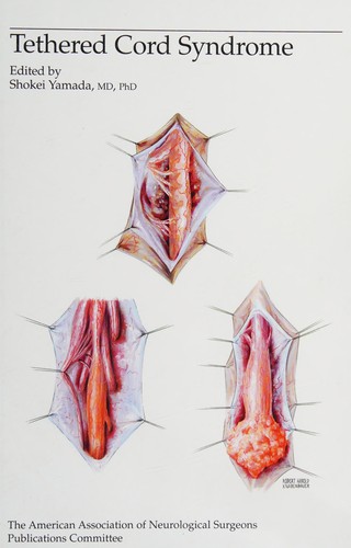 Cover for Tethered Cord Syndrome (Special Topics Series)