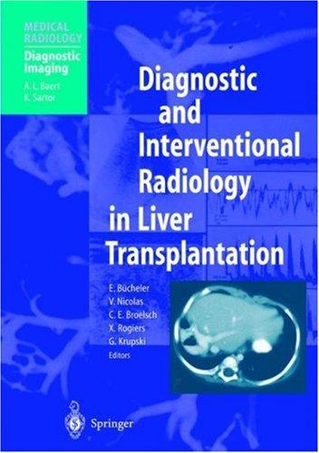 Cover for Diagnostic and Interventional Radiology in Liver Transplantation (Medical Radiology / Diagnostic Imaging)