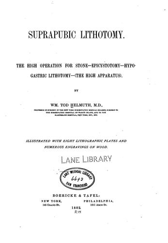 Cover for Suprapubic lithotomy: the high operation for stone, epicystotomy, hypogastric lithotomy (the ...
