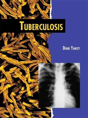 Cover for Tuberculosis