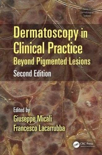 Cover for Dermatoscopy in Clinical Practice, Second Edition