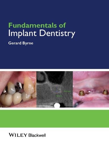 Cover for Fundamentals of Implant Dentistry