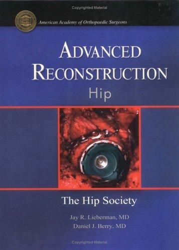 Cover for Advanced Reconstruction Hip (Advanced Reconstruction)