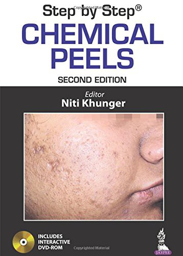 Cover for Step by Step Chemical Peels