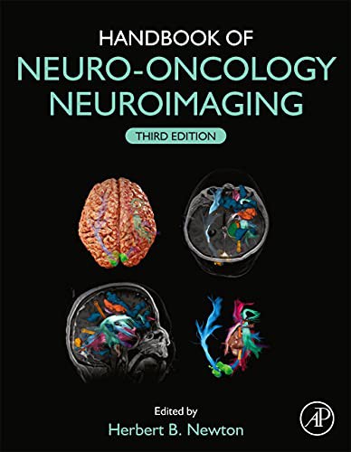 Cover for Handbook of Neuro-Oncology Neuroimaging