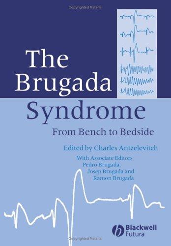 Cover for The Brugada syndrome