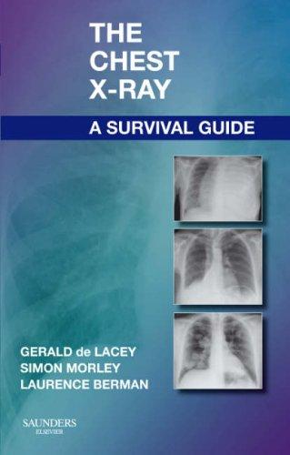 Cover for The Chest X-Ray