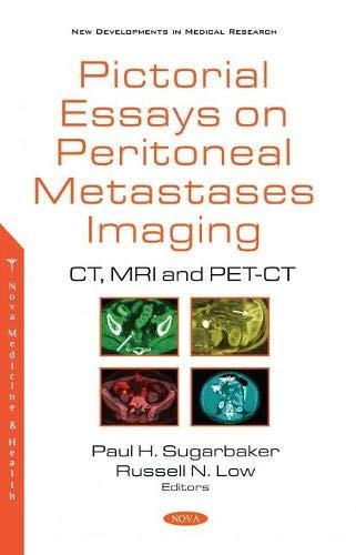 Cover for Pictorial Essays on Peritoneal Metastases Imaging