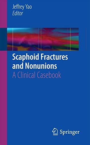 Cover for Scaphoid Fractures and Nonunions