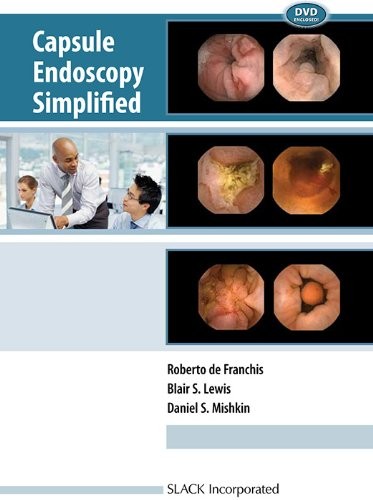 Cover for Capsule endoscopy simplified
