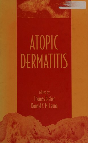 Cover for Atopic dermatitis