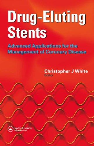 Cover for Drug-Eluting Stents