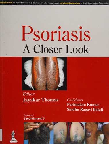 Cover for Psoriasis