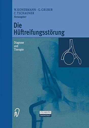 Cover for Die Hüftreifungsstörung