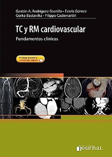 Cover for TC y RM cardiovascular
