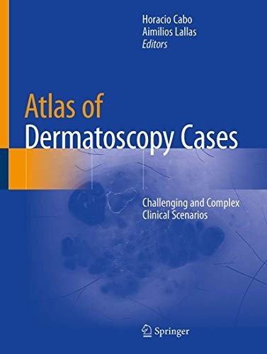 Cover for Atlas of Dermatoscopy Cases