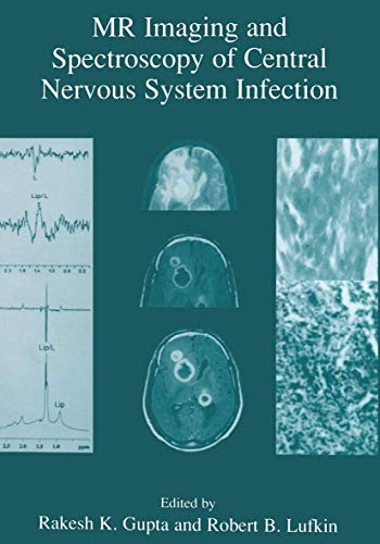 Cover for MR Imaging and Spectroscopy of Central Nervous System Infection