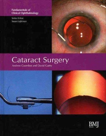 Cover for Cataract Surgery (Fundamentals of Clinical Ophthalmology)