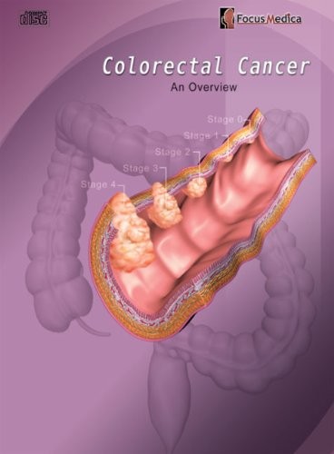 Cover for Colorectal Cancer