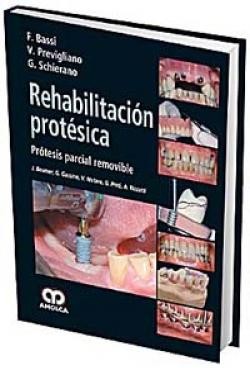 Cover for Rehabilitación protésica protesis parcial removible