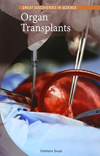 Cover for Organ Transplants
