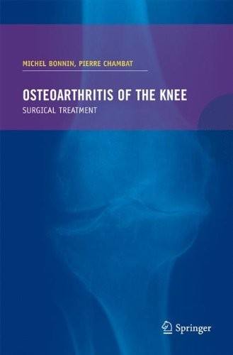 Cover for Osteoarthritis of the knee