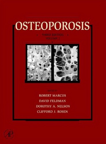 Cover for Osteoporosis