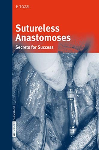 Cover for Sutureless Anastomoses