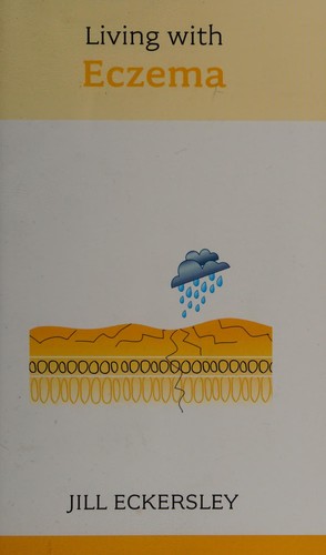 Cover for Living with eczema
