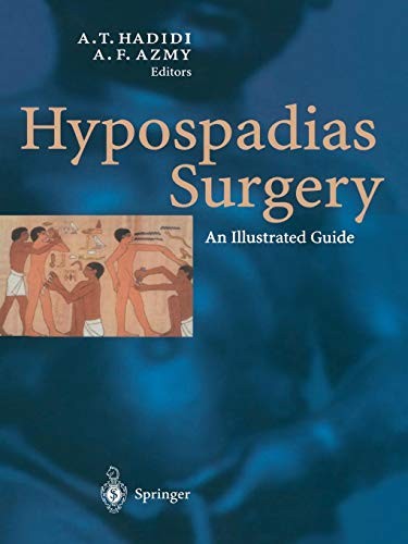 Cover for Hypospadias Surgery