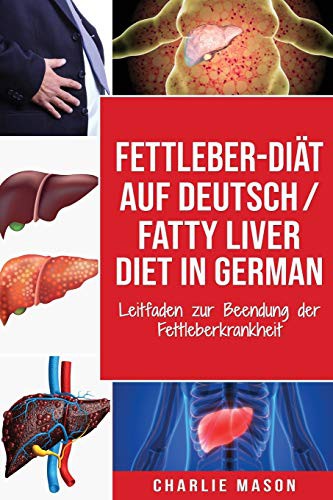 Cover for Fettleber-Diät Auf Deutsch/ Fatty liver diet In German