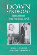 Cover for Down's Syndrome: Birth to Adulthood 