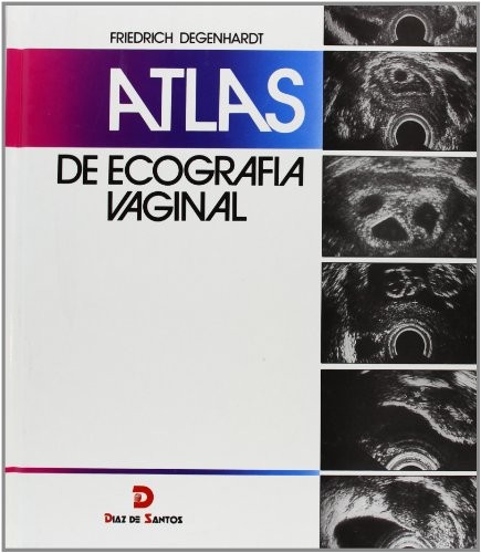 Cover for Atlas de ecografía vaginal