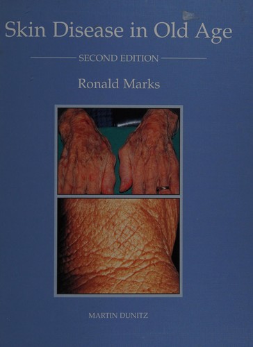 Cover for Skin disease in old age