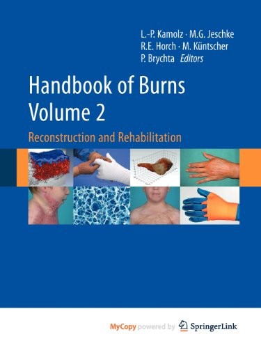 Cover for Handbook of Burns Volume 2