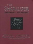 Cover for The Shoulder