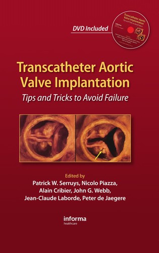 Cover for Transcatheter aortic valve transplantation