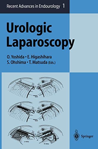 Cover for Urologic Laparoscopy