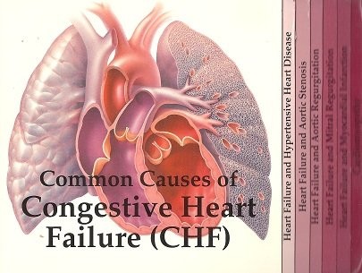 Cover for Common Causes of Congestive Heart Failure