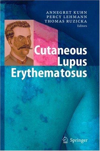 Cover for Cutaneous Lupus Erythematosus