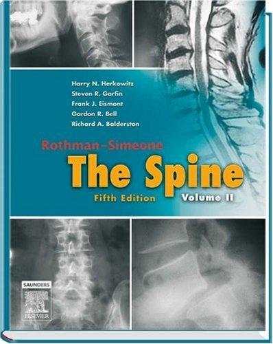 Cover for Rothman-Simeone The Spine