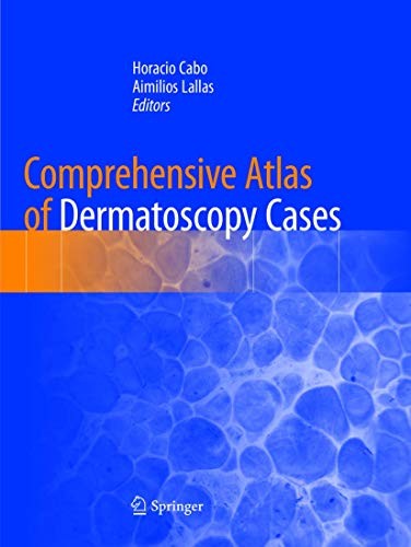 Cover for Comprehensive Atlas of Dermatoscopy Cases