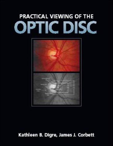 Cover for Viewing the Optic Disc