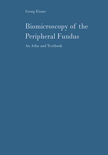 Cover for Biomicroscopy of the Peripheral Fundus