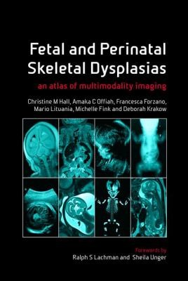 Cover for Fetal And Perinatal Skeletal Dysplasias An Atlas Of Multimodality Imaging