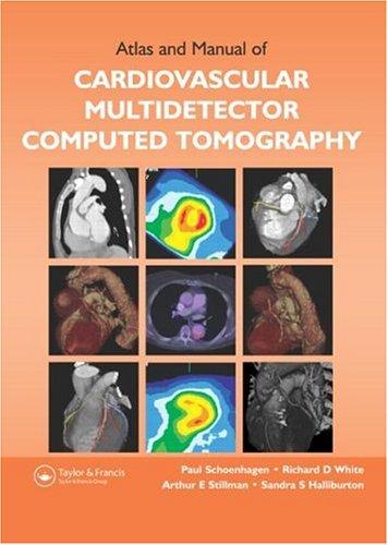 Cover for Atlas and Manual of Cardiovascular Multidetector Computed Tomography